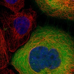 Lactate Dehydrogenase B Antibody, Novus Biologicals 0.1mL; Unlabeled:Antibodies,